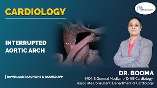 Cardiology | Interrupted aortic arch | Raaonline