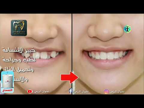 بقية الحلقه 95 |أرض الأمل