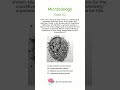 Microbiology - Case 52