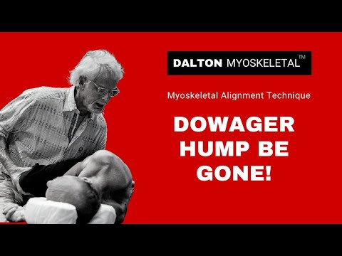 Deep Tissue Massage and Manual Therapy for Relieving Dowager's Hump