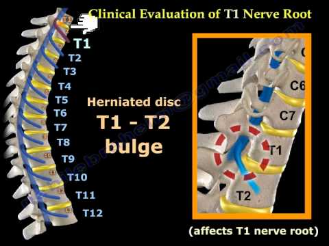 Neurological Examination Spinal Cord Part 3 Everything You Need To Know Dr Nabil Ebraheim Youtube
