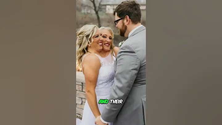 Hensel Conjoined Twins Get Married But They Aren’t the First! #shorts