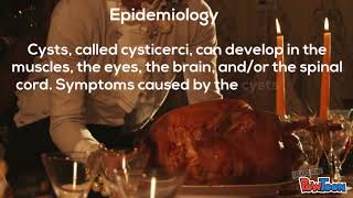 Neurocysticercosis