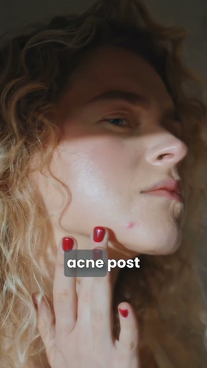 does-whey-protein-cause-acne-watch-this-to-know-more-youtube