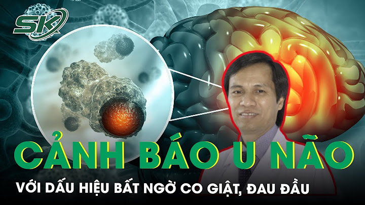 Lên cơn co giật là bệnh gì năm 2024