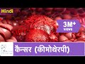     cancer chemotherapy  hindi