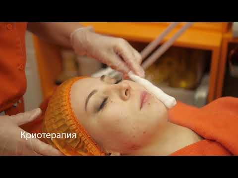 Криотерапия для лица