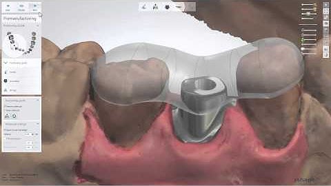 Positioning guide design