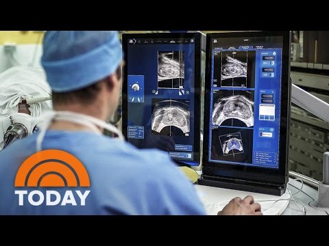 When To Undergo Cancer Screenings: Colon, Prostate, Mammograms, Cervical | TODAY