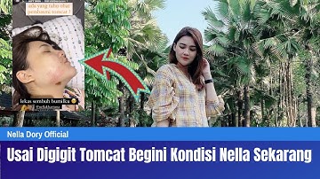 Dory Harsa Bagikan Kabar Terbaru Nella Kharisma Setelah Wajah di Serang Tomcat