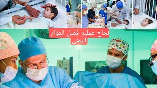 نجاح عمليه فصل التؤام الطفيلي اليمني  #التؤام_الطفيلي_اليمني