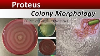 Proteus Colony Morphology  ( Clear Explain )