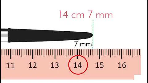 ¿Qué constituye 1 mm?