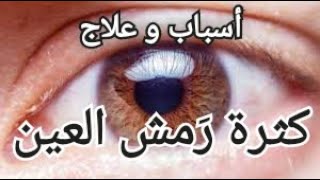 أسباب زيادة رَمش العين و علاجها excessive blinking #العين #eyes