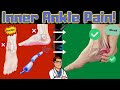 Inside of the Ankle Pain [Tarsal Tunnel Syndrome Treatment & Symptoms]