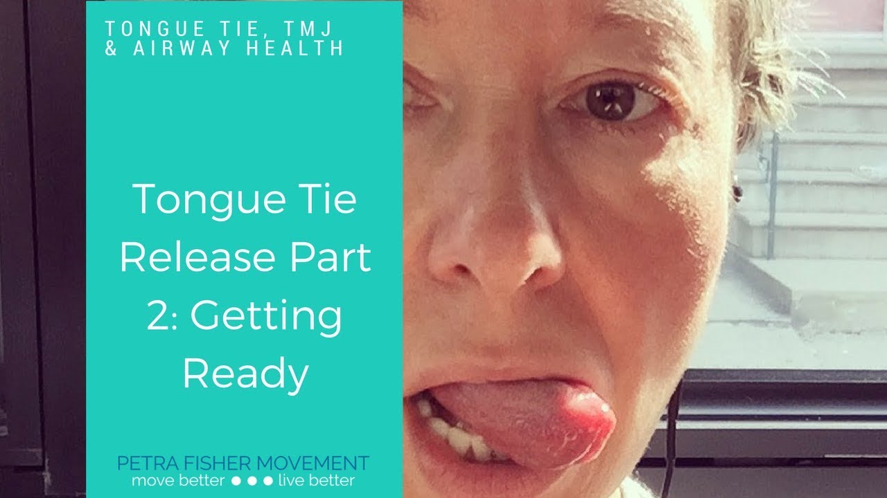 Tongue Tie Release Part 2: Prep 