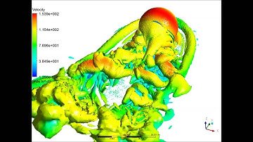 SAS Large Vorticity Radome Analysis