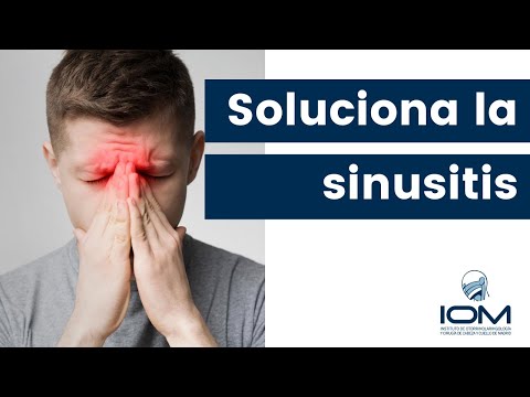 Vídeo: 4 maneres de tractar la sinusitis crònica