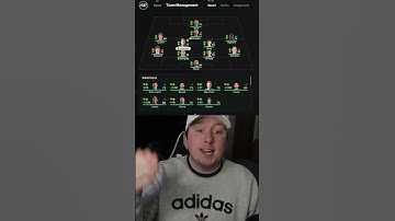 3 Things That SUCK in FC 25 Career Mode