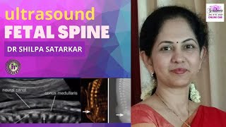 YOUTUBE LIVE | FETAL SPINE IMAGING | DR SHILPA SATARKAR | TIPS & TRICKS TO CATCH SUBTLE LESIONS