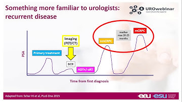 Urowebinar: Identification and management of patients with nmCRPC