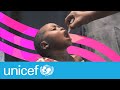 La vaccination fait partie des plus grands accomplissements de lhumanit  unicef