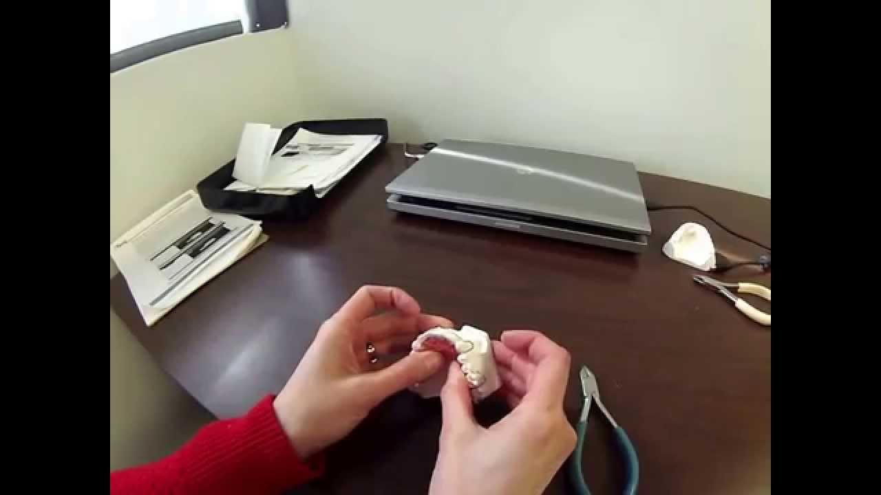 Hawley Labial Bow Adjustments