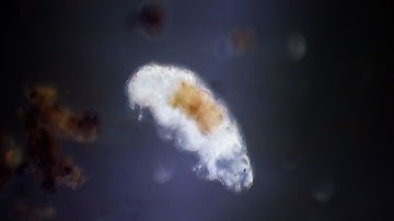 A close-up of creatures living beneath the soil - Deep Down & Dirty: The Science of Soil - BBC