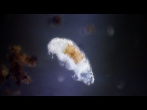 A close-up of creatures living beneath the soil - Deep Down & Dirty: The Science of Soil - BBC Four