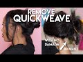 REMOVE QUICKWEAVE | EASIEST METHOD | NO DAMAGE