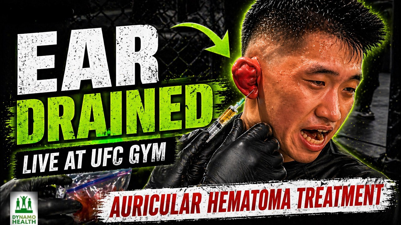 This Is How Fighters Get Cauliflower Ear… And How You Stop It