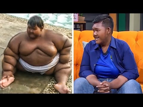 Video: Der Dickste Junge Der Welt Reduzierte Seinen Magen Und Verlor 100 Kg - Alternative Ansicht