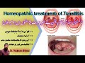 How to treat tonsillitis in homeopathy by Dr. Nauman Ahmad in [Urdu/Hindi]