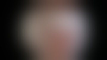 The Loop ‘N’ Tack Biceps Tenodesis: An All-Arthroscopic, Intra-Articular Technique