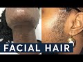 How to remove Facial Hair - The TRUTH about Laser Hair Removal