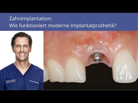 Video: Zahnprothetik Oder Implantation?