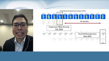 Christopher LEUNG. HOW TO DETECT GLAUCOMA PROGRESSION? THE CURRENT CONCEPTS