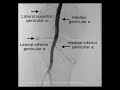 The TAME Lab: Knee Artery Anatomy Episode 2