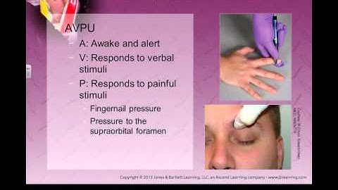 Neurological emergencies part 1