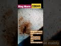 Ringworm FungusЁЯжа Under Microscope Ringworm FungusЁЯжа Under Microscope