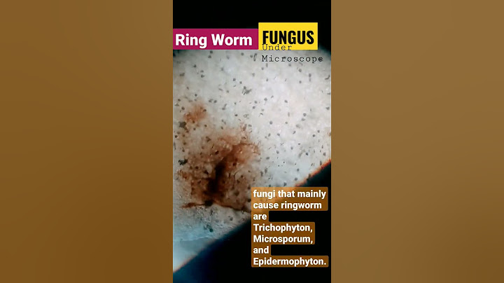 Ringworm Fungus🦠.Under Microscope