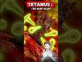 Jung lagi keel = MAUT? 😱🔩 (Tetanus Truth) #tetanus