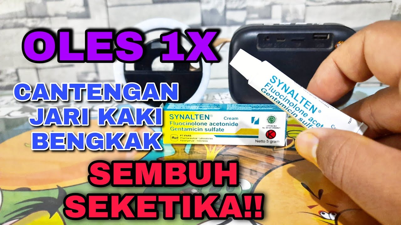 🔥Cara Ampuh Mengatasi Cantengan Jempol Dan Jari Kaki di Rumah ️