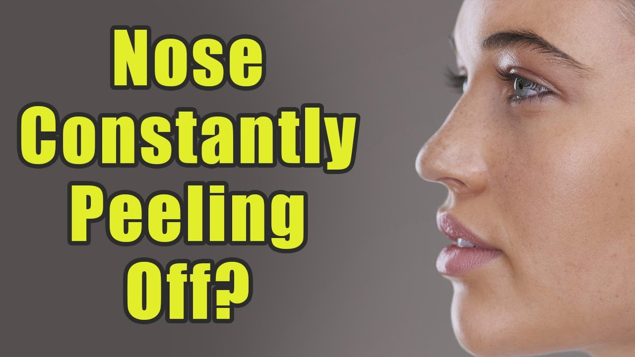 Is Your Skin On Both The Sides Of Your Nose Constantly Peeling Off Try These Remedies Boldsky Youtube