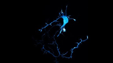 Lightning in the Brain