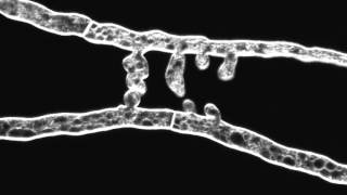 Chemotropic interaction between fusion hyphae in N. crassa. Hyphae stained with FM4-64. screenshot 4