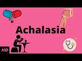 Achalasia, Causes, Signs and Symptoms, Diagnosis and Treatment.