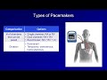 An Introduction to Pacemakers