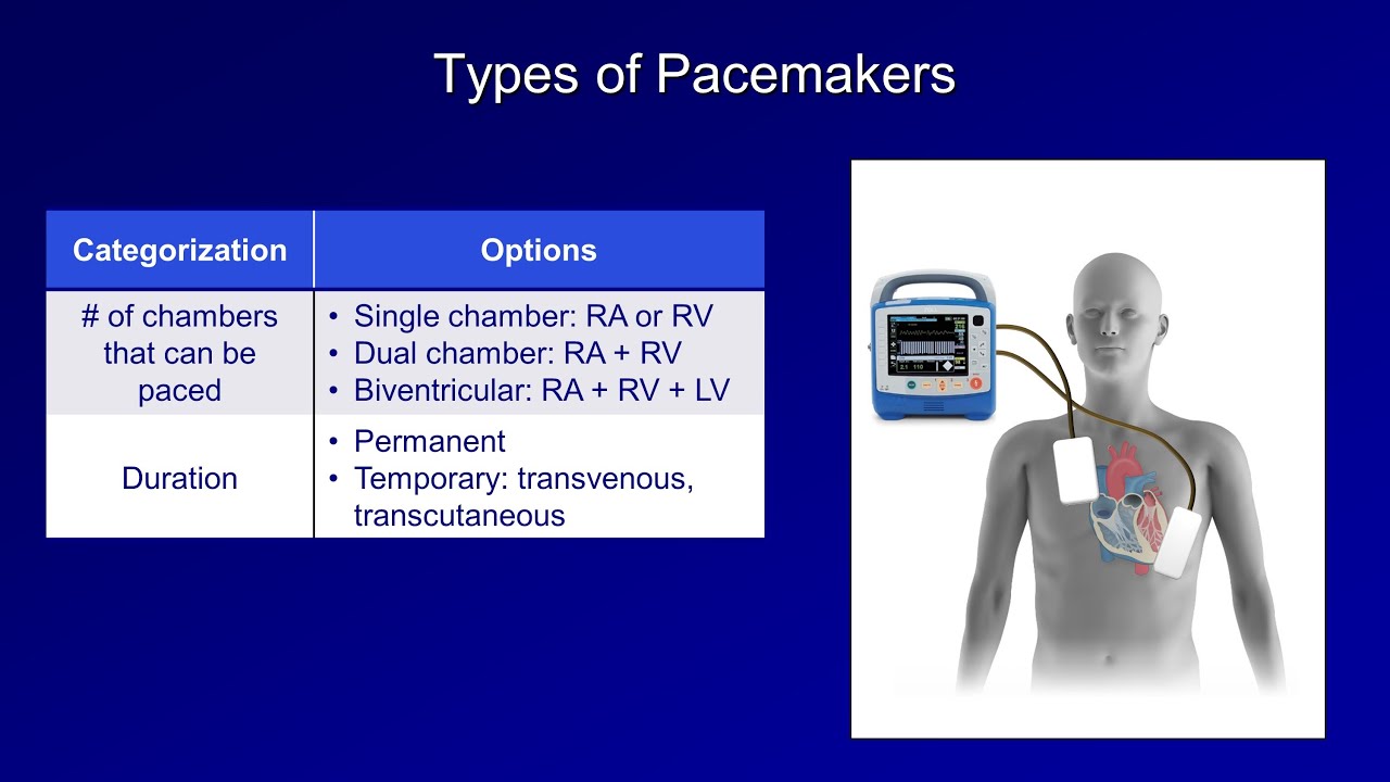 An Introduction to Pacemakers