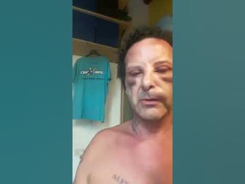 Alex Magni: eco a voi la mia seconda aggressione, subita in due anni - YouTube